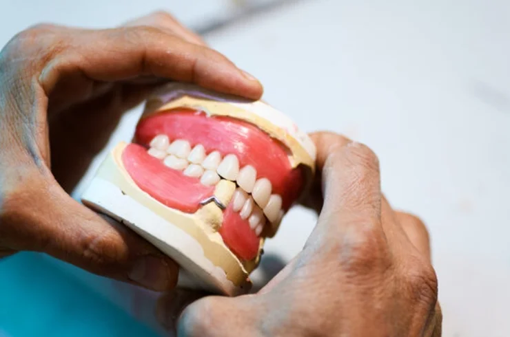 Prosthodontics------14