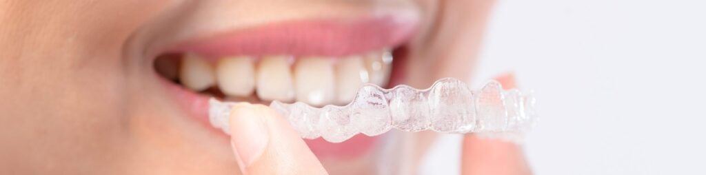 invisalign-braces